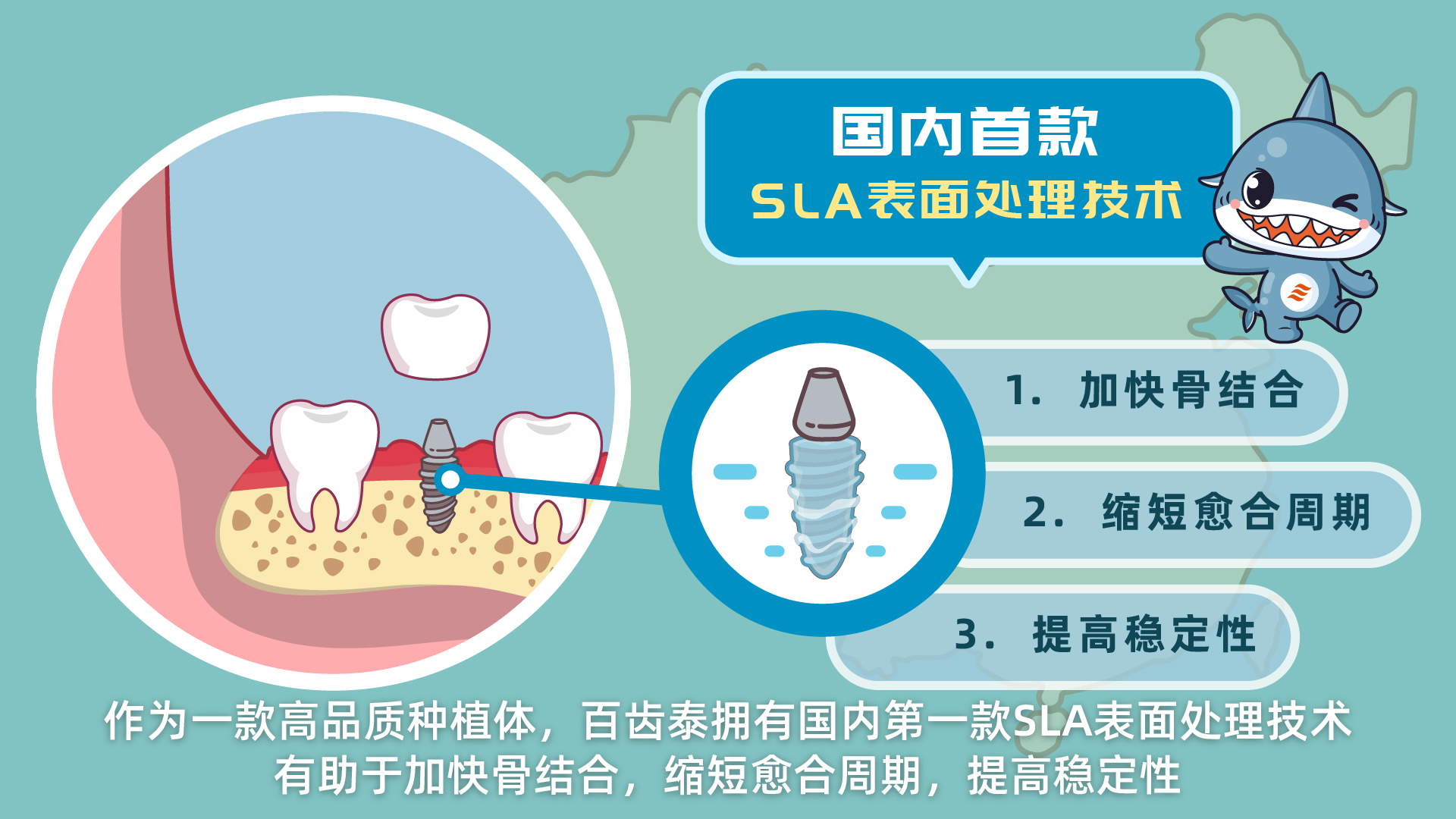 种植牙动画定制